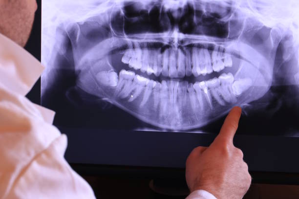 Best Emergency Dental Extractions in Rogersville, TN
