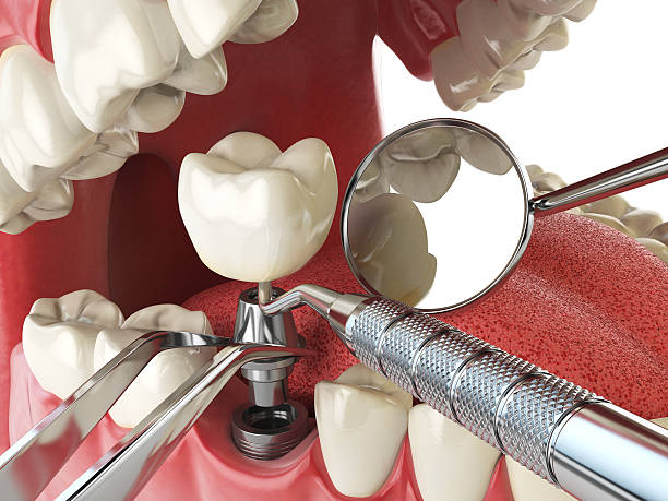Best Emergency Root Canal Treatment in Rogersville, TN